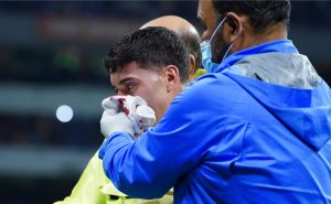 Alejandro Zendejas tendrá que ser operado luego de recibir un duro impacto en la cara en el partido entre América contra Monterrey del Clausura 2023. Foto: Imago7
