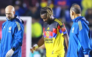 América sufre importantes bajas ante Santos Laguna.